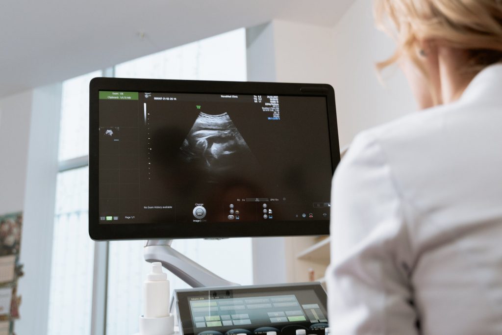 Ilustrasi seorang dokter sedang melihat hasil tes kesuburuan rahim